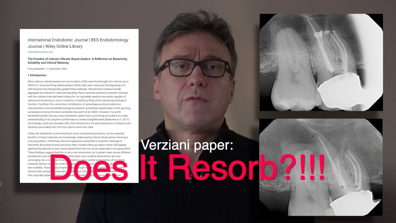 Bioactivity vs Stability in Endodontic Sealers: are We Overcorrecting?