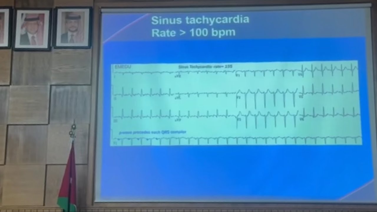 Seminar . ECG 2 | Dr.Akram