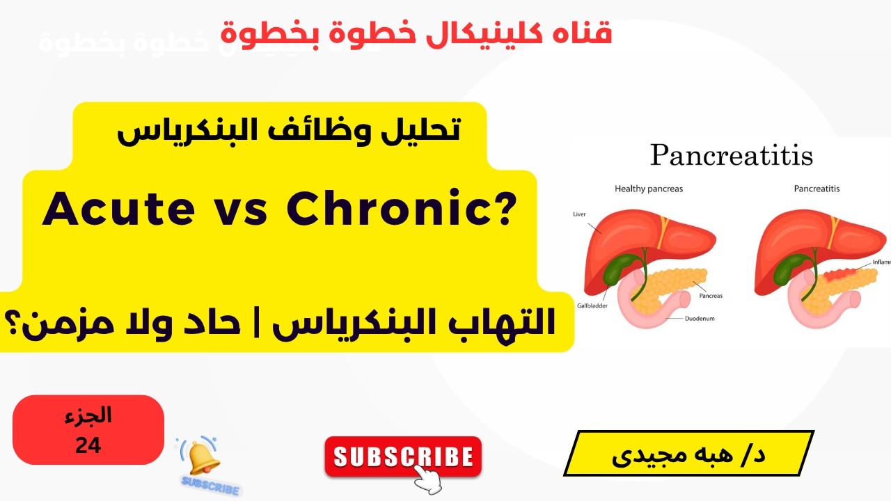 الجزء 24 Acute vs Chronic Pancreatitis الفرق بين التهاب البنكرياس الحاد والمزمن ببساطة
