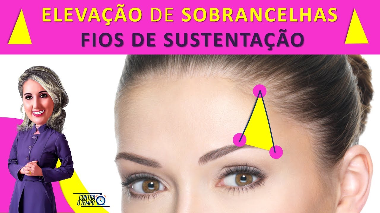 Sobrancelha Arqueada: Como elevar a sobrancelha com Fios de Sustentação - "FOX EYES"