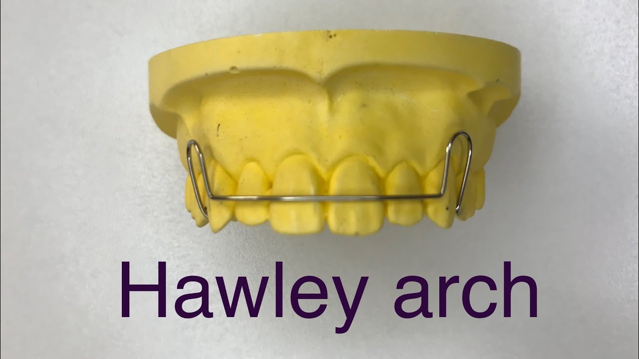 Wire bending series: Episode XIV Hawley arch
