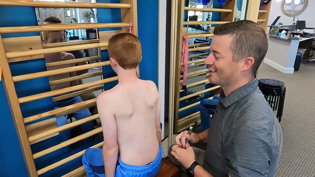 Upper Thoracic Scoliosis Curve with Schroth Method Exercises