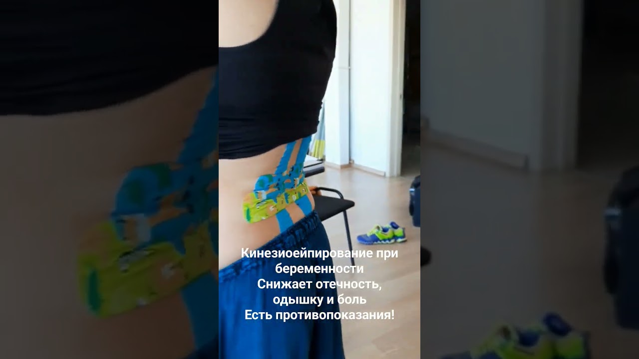 #тейпирование