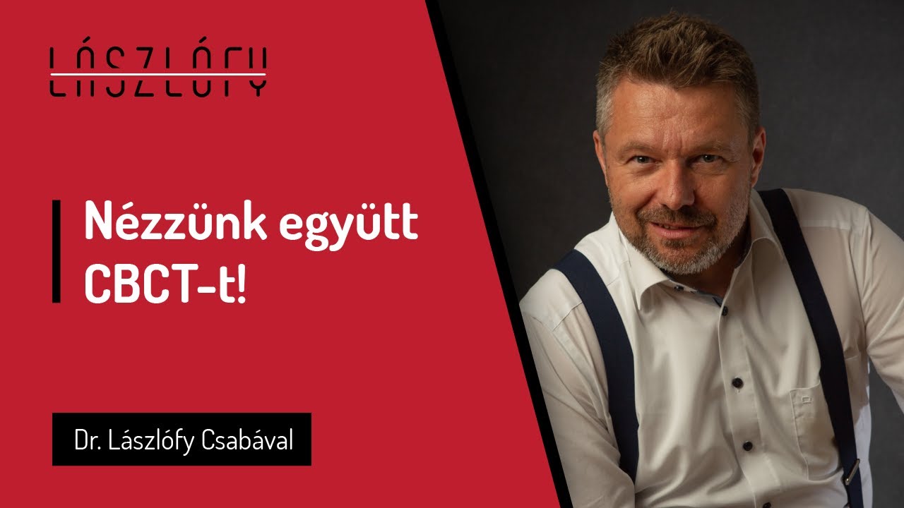Fog eredetű arcüreggyulladás CBCT-n - amikor a fog okozza a sinusitist