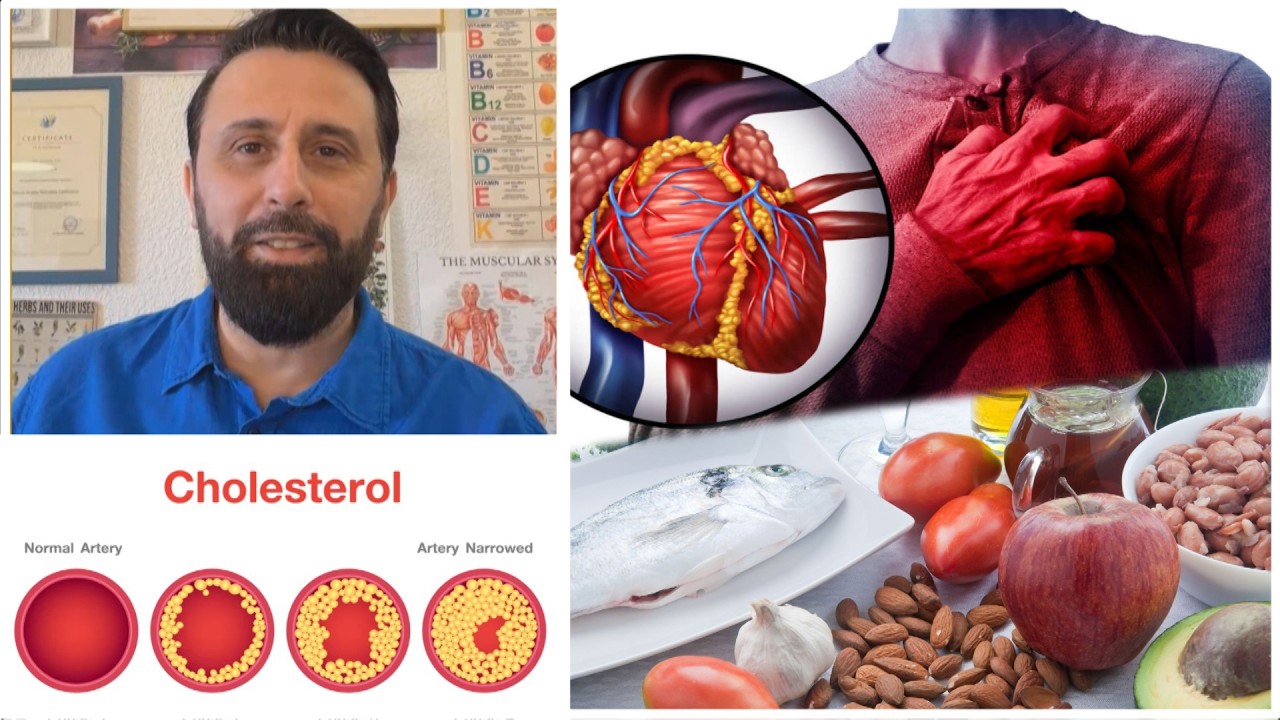 Jo kolesteroli, por trigliceridet janë PROBLEM / Mënyrat më të mira për t’i mbajtur në kontroll