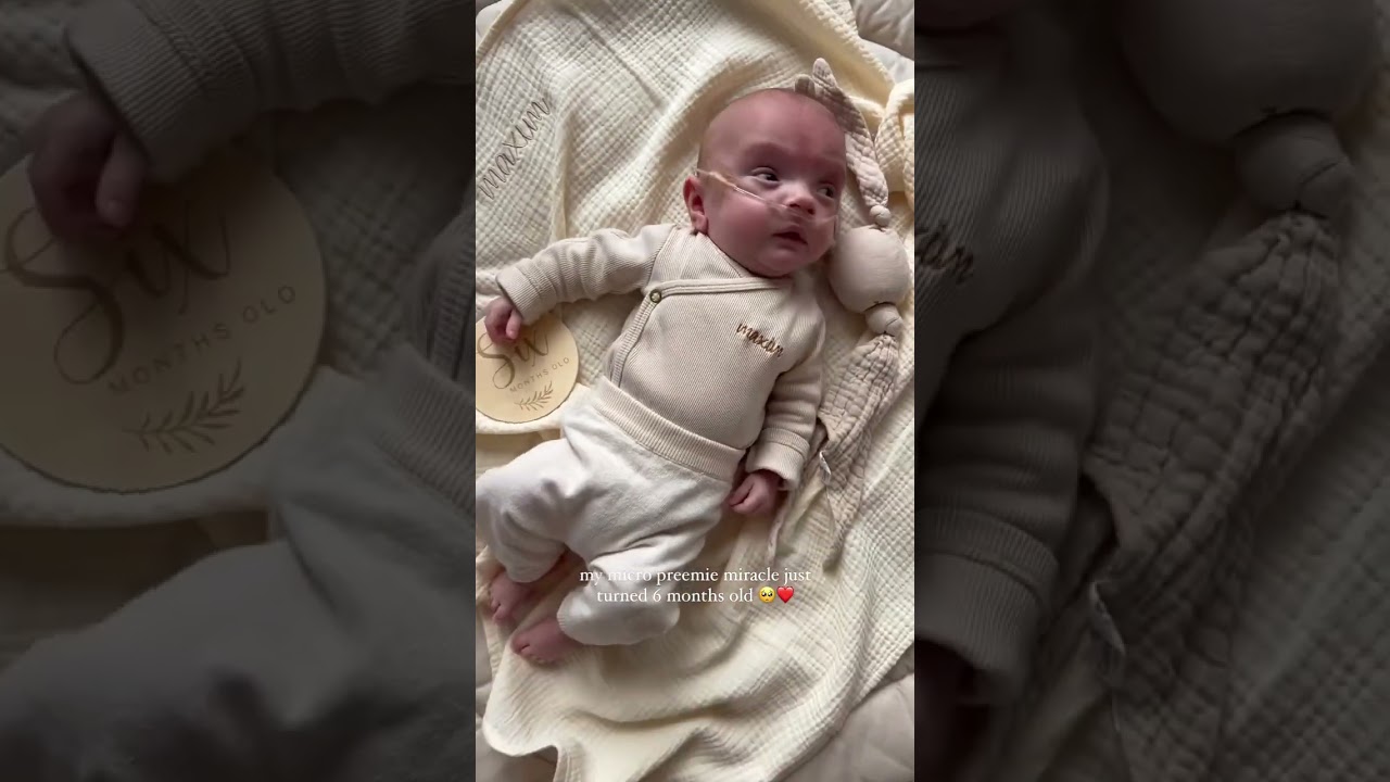 PREMATURO DE 25 SEMANAS ANTES E DEPOIS 