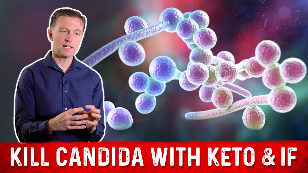 Kill Candida with Keto & Intermittent Fasting – Dr. Berg
