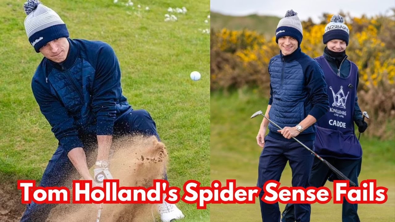 Tom Holland sports a bruise after 'being hit on the head with a golf ball