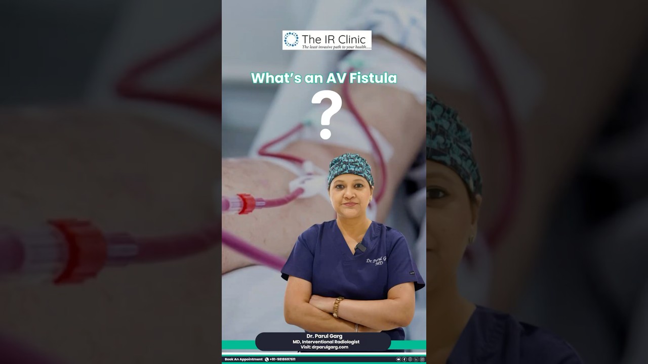 👉 AV Fistula Explained | Lifeline for Dialysis Patients
