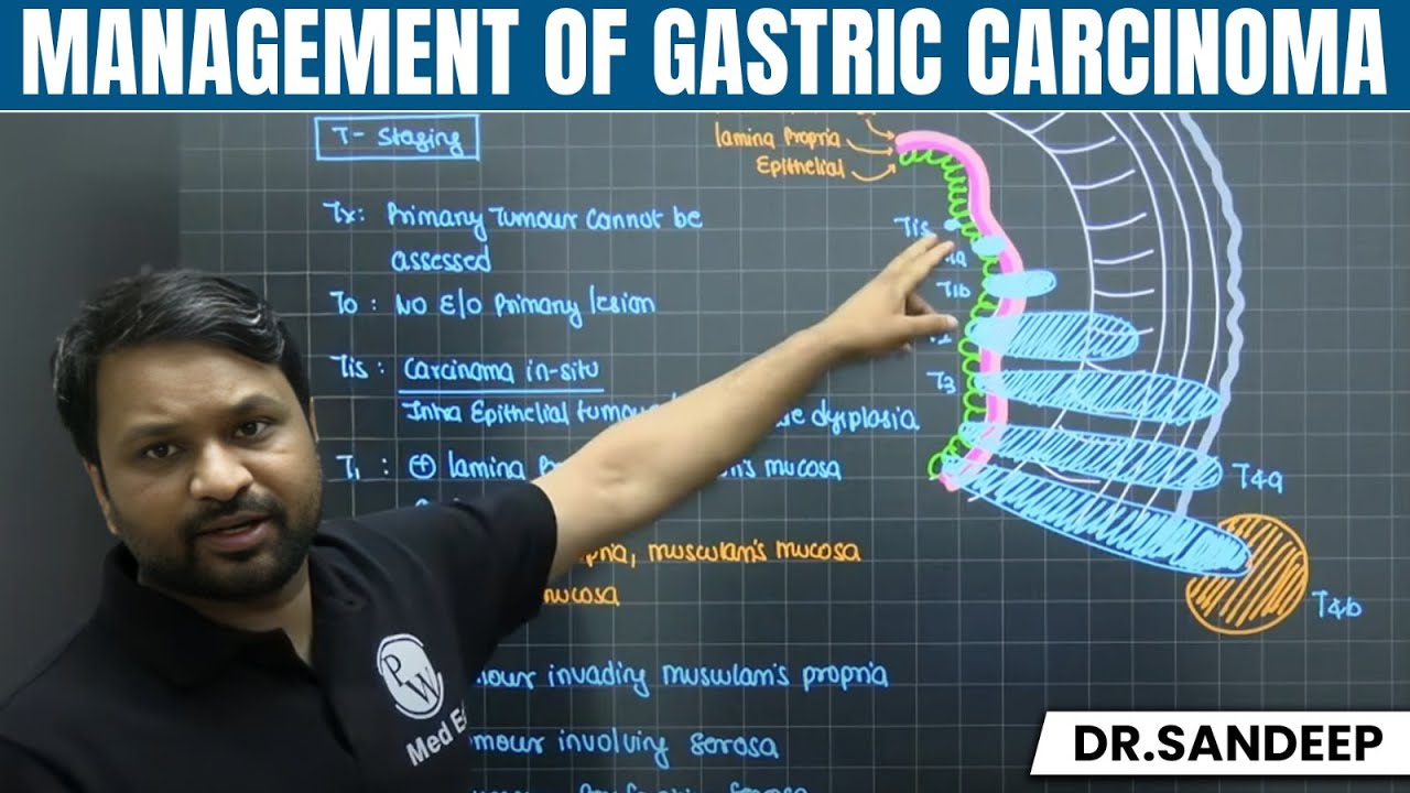Management of Gastric Carcinoma | Surgery | Bailey learned with Dr. Sandeep | PW MedEd