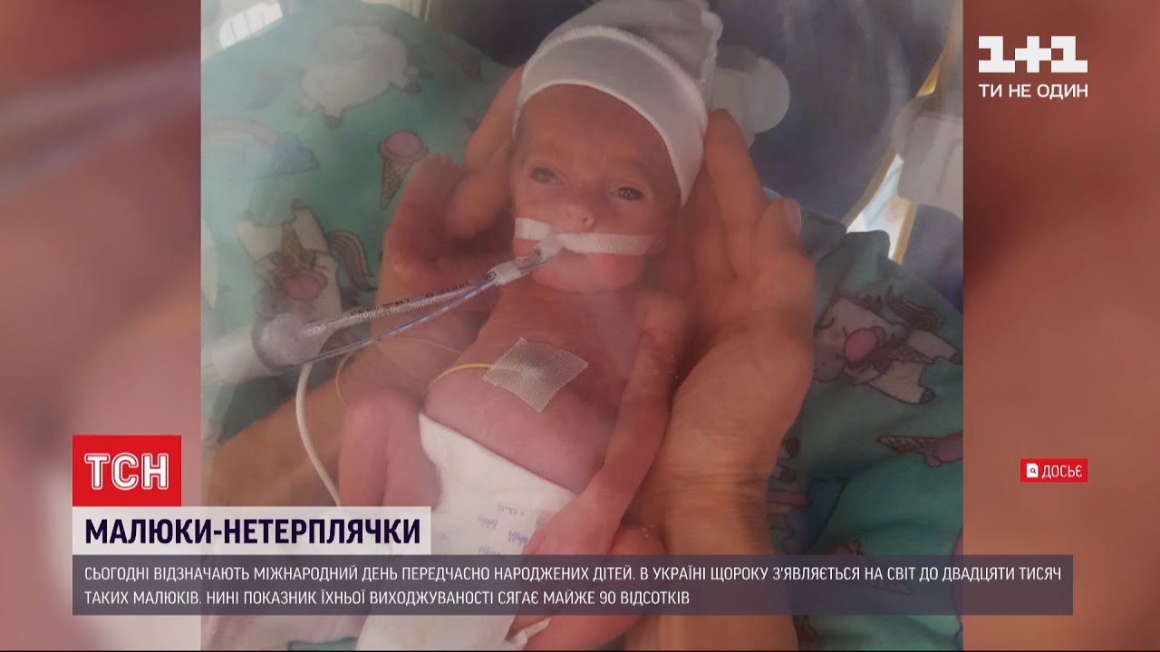 Маленькі поспішайки: ТСН зібрала зворушливі історії передчасно народжених українців