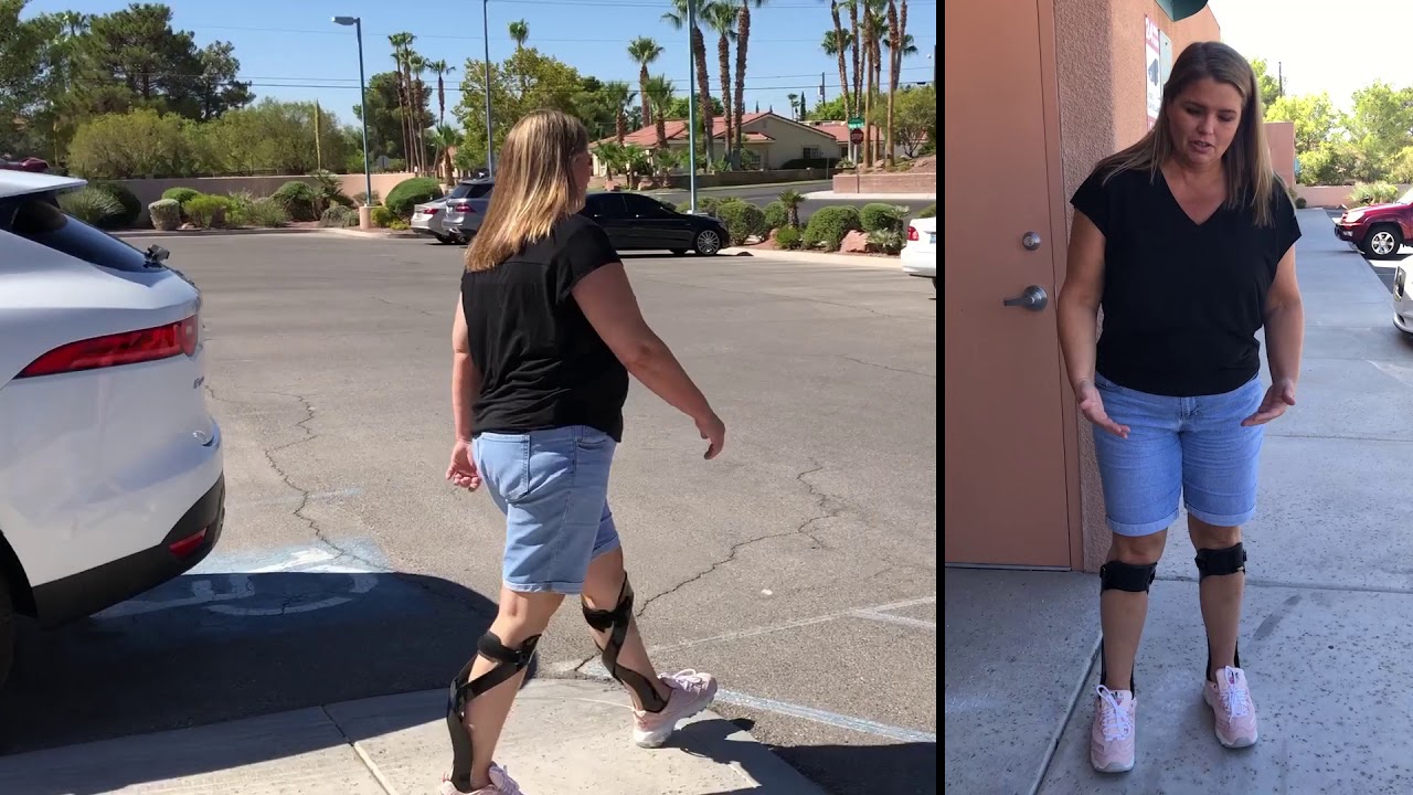 Helios - CMT Bracing: Robin says her Balance and Gait feel Amazing