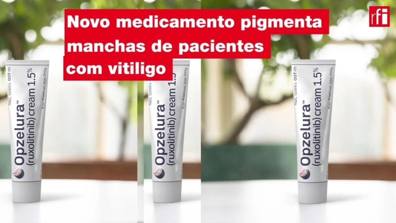 Novo medicamento pigmenta  manchas de pacientes com vitiligo • RFI Brasil