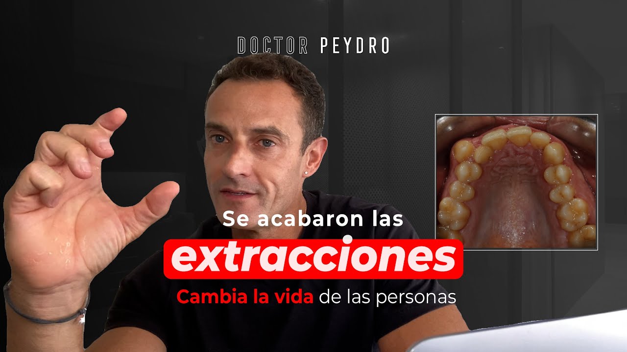 ❌🦷 Ortodoncia SIN EXTRACCIONES ¿Es posible?