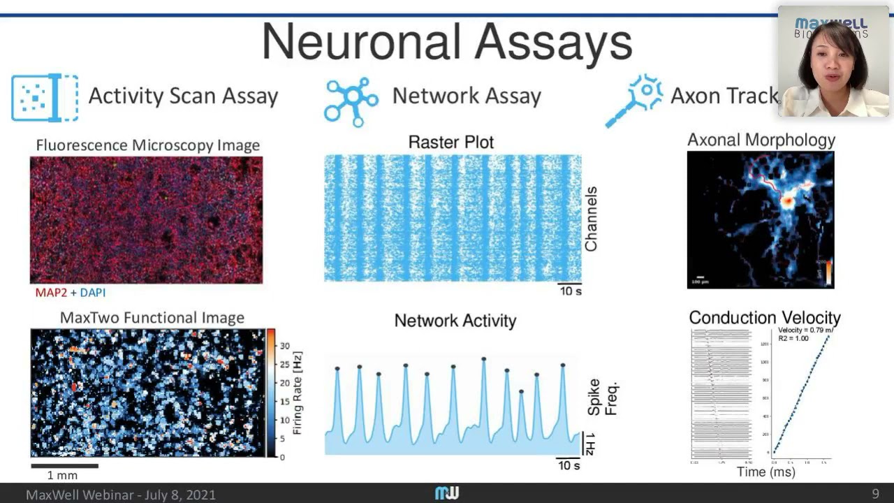 Phenotyping of neurodevelopmental disorders with hiPSC-derived dopaminergic neurons