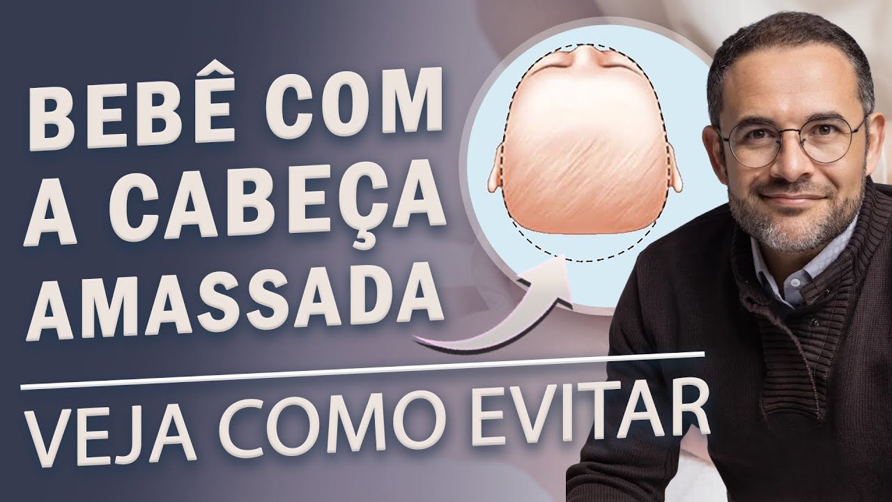 Bebê com a CABEÇA achatada ( PLAGIOCEFALIA ) - TUDO que os PAIS precisam saber para EVITAR e TRATAR