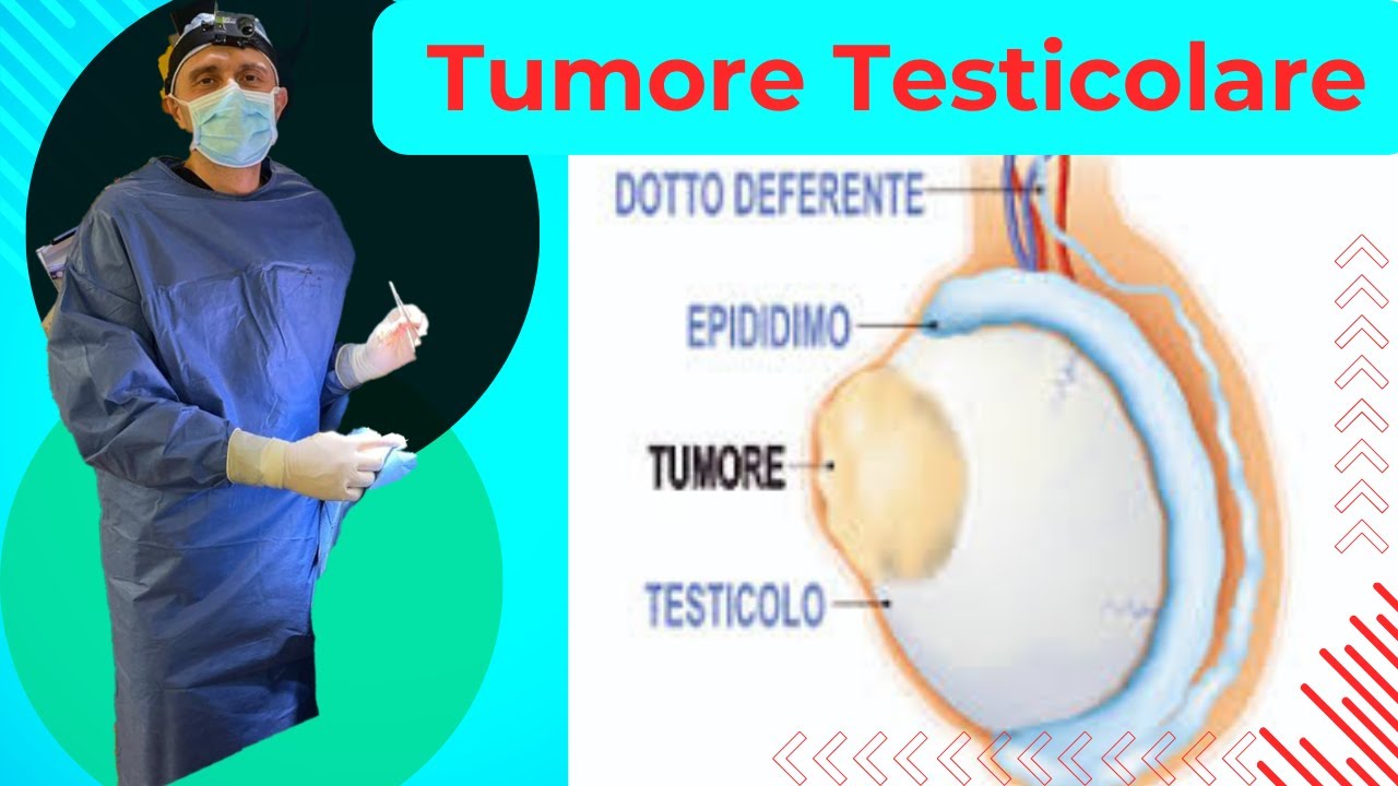 Il tumore testicolare: cosa fare ?