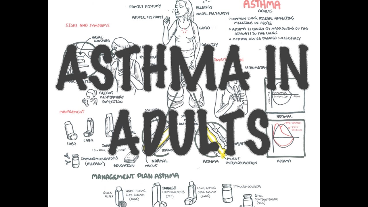 Adult Asthma - Overview (signs and symptoms, pathophysiology, investigations and treatment)