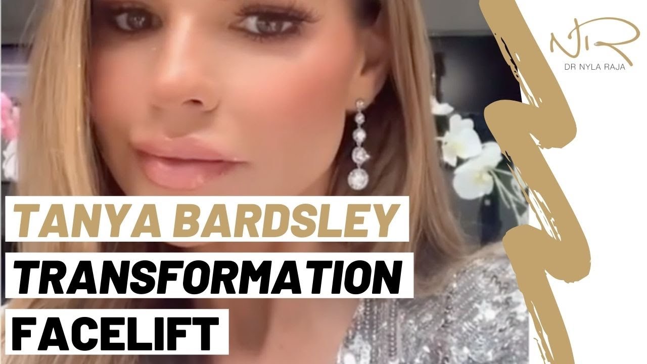 Tanya Bardsley - Dr Nyla Raja's Transformation Facelift 😍
