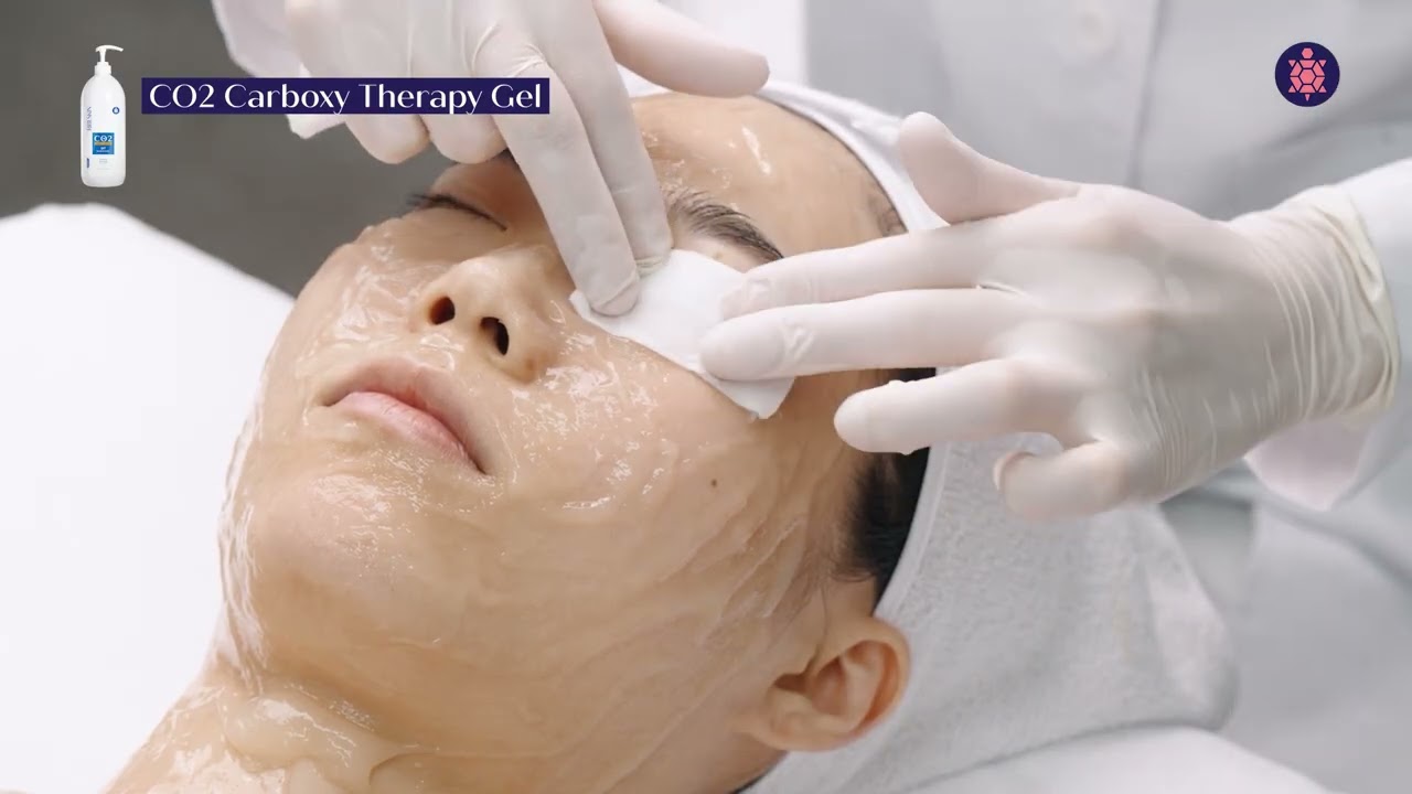 Face and Decollete CO2 Carboxy Therapy by Ribeskin - Video Tutorial