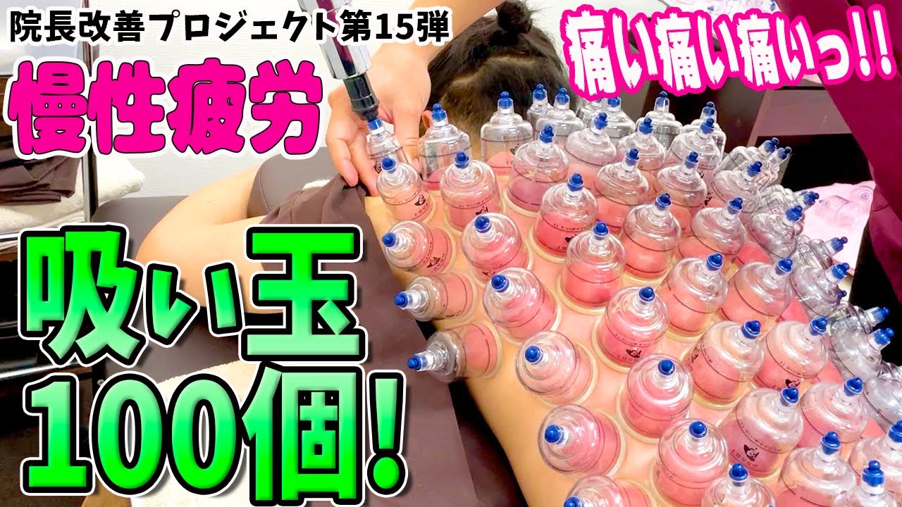 【吸い玉 100個】検証！吸い玉 100個で院長の慢性疲労は改善されるのか？吸い玉 100個つけてみた！【院長吸い玉改善プロジェクト15】