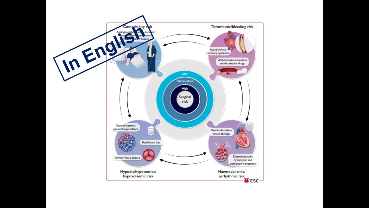 ESC Guidelines: 1. Preoperative Consultation (English Version)