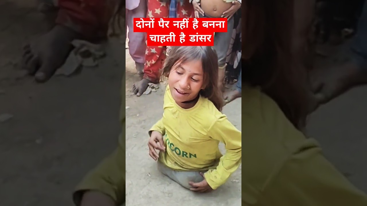 दोनों पैर नहीं है बनना चाहती है डांसर।।