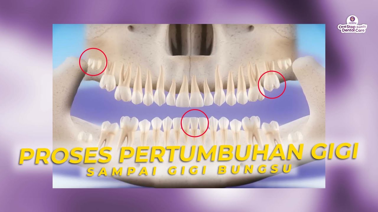 PROSES PERTUMBUHAN DARI GIGI SUSU SAMPAI GIGI BUNGSU!!!