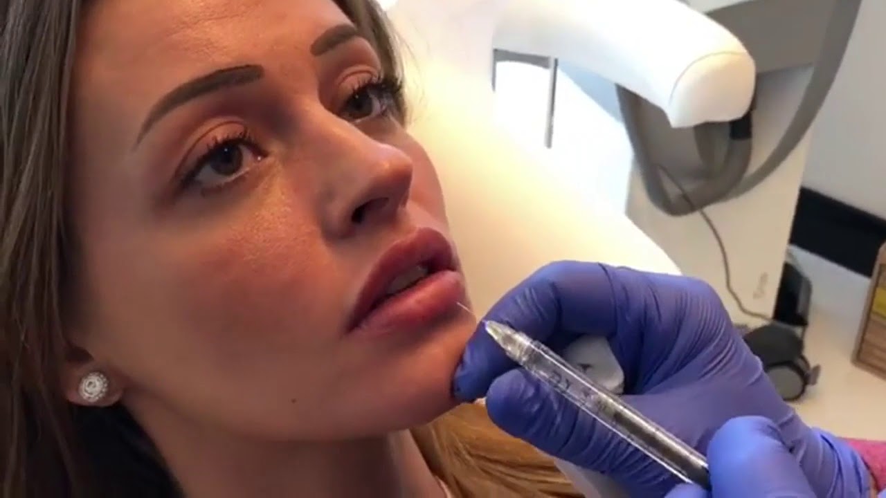 Dúsabb ajkak - néhány perc alatt