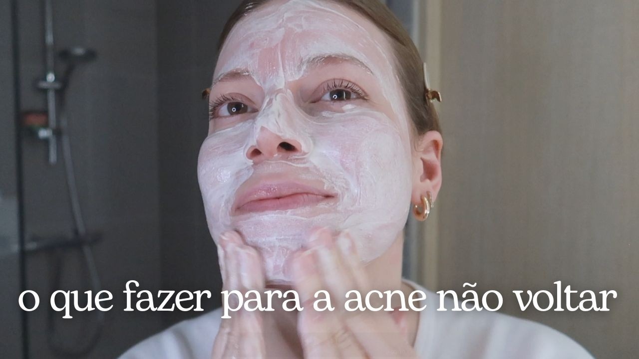 Rotina de Skincare para Manter a Acne Controlada + primeiras impressões da linha antiacne da Garnier