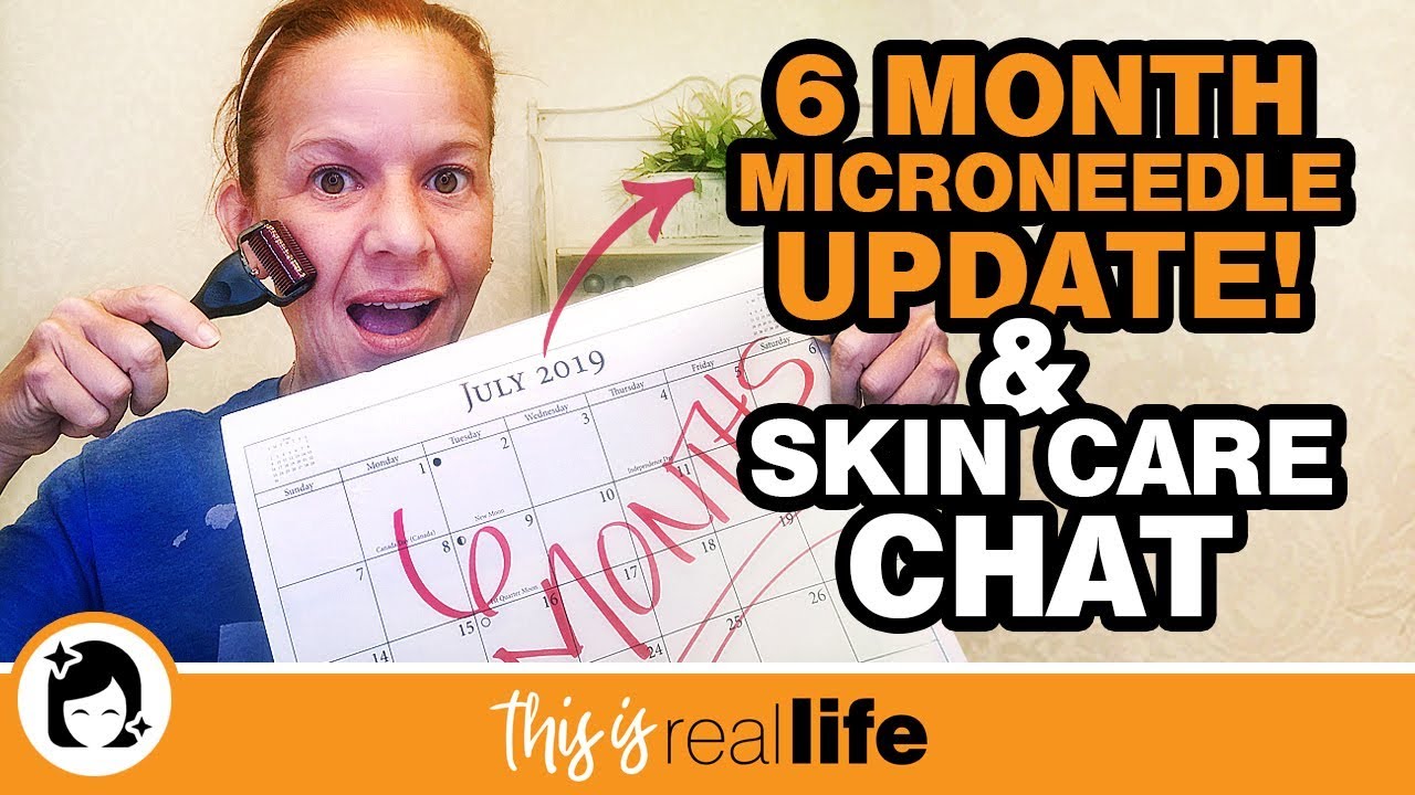 My At Home Microneedling Experience 6 Month Update & Skin Care Chat - THIS IS REAL LIFE