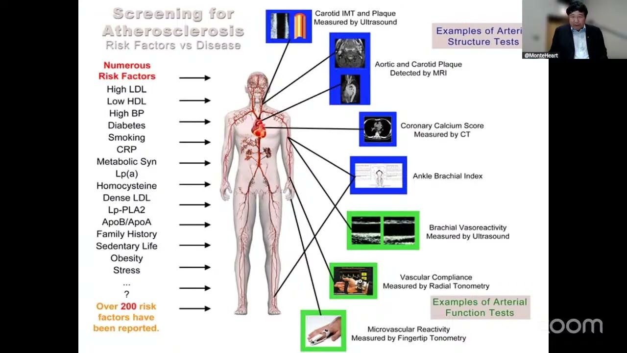 Coronary Calcium: Evolution, Role in Preventive Cardiology and Opportunistic Testing