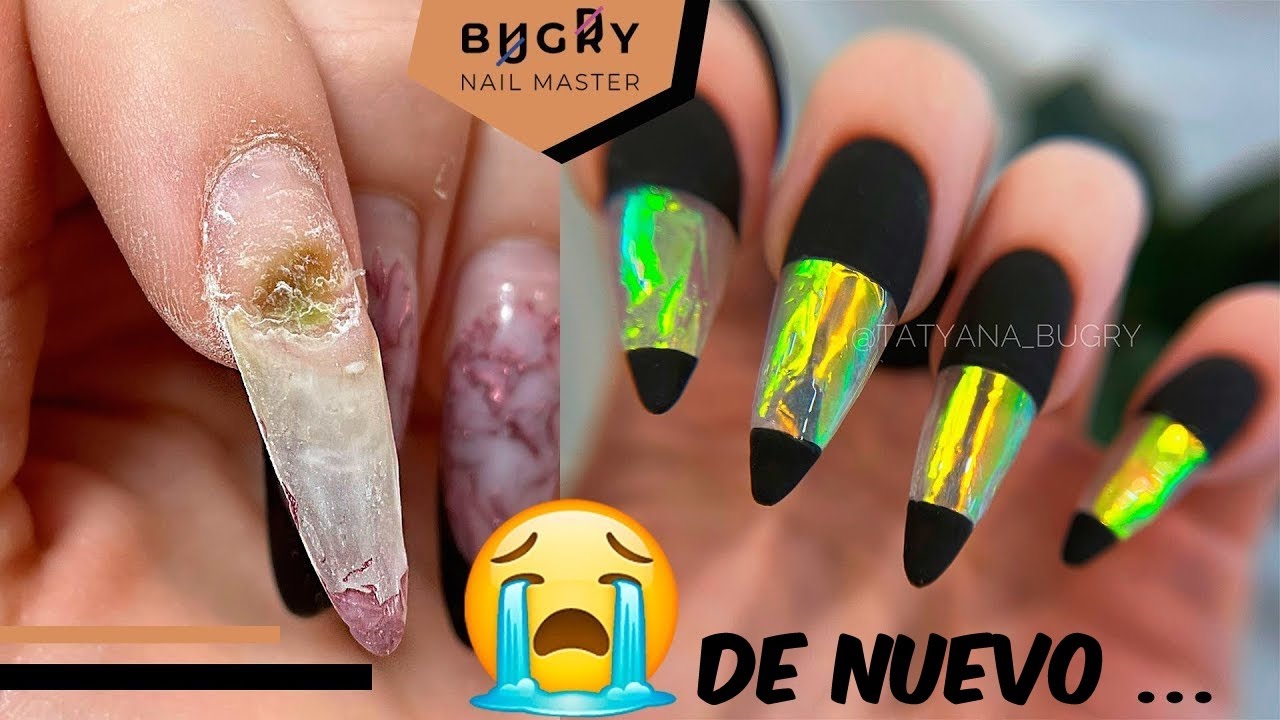 DESPRENDIMIENTO DE UÑAS Y HONGOS DE NUEVO😭 Nuevas extensiones de uñas!