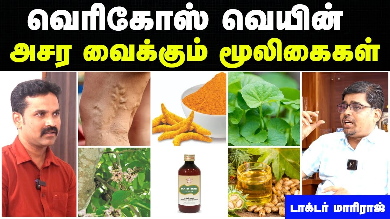 வெரிகோஸ் வெயின் அறிகுறிகள் | vericose vein problem in tamil | Narambu surutal in tamil | Doctor