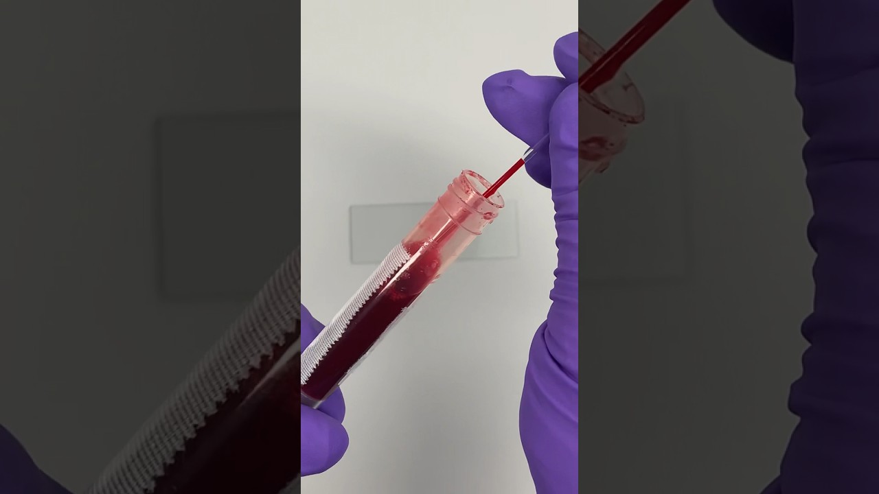 Blood Smears #clinicalskills #bloodsmear #blood #veterinary #medicine #studying #vetschool