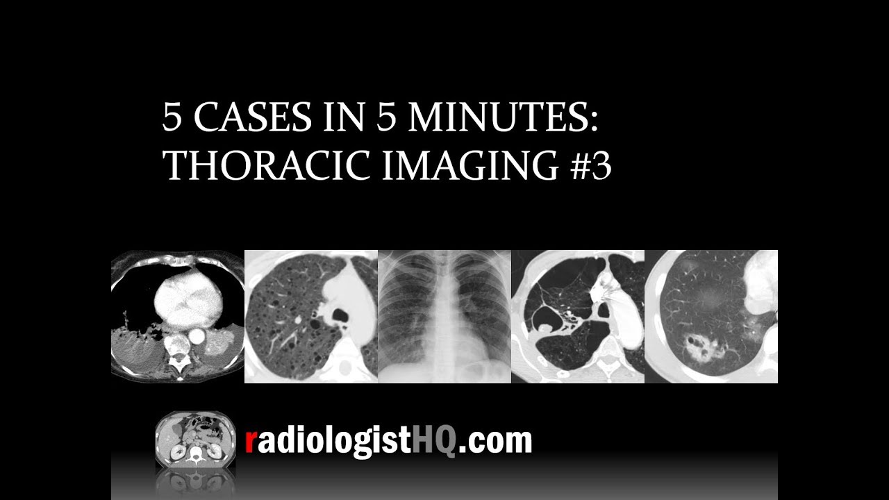 5 Cases in 5 Minutes: Thoracic #3