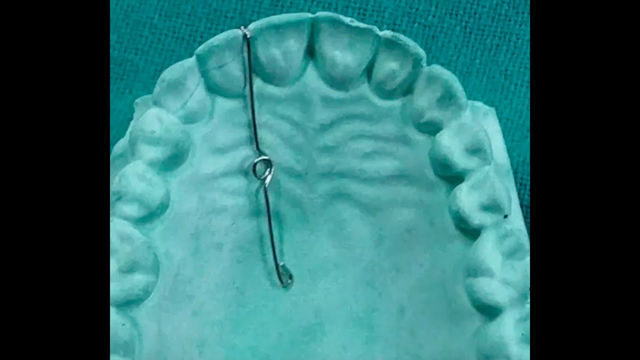 Finger Spring