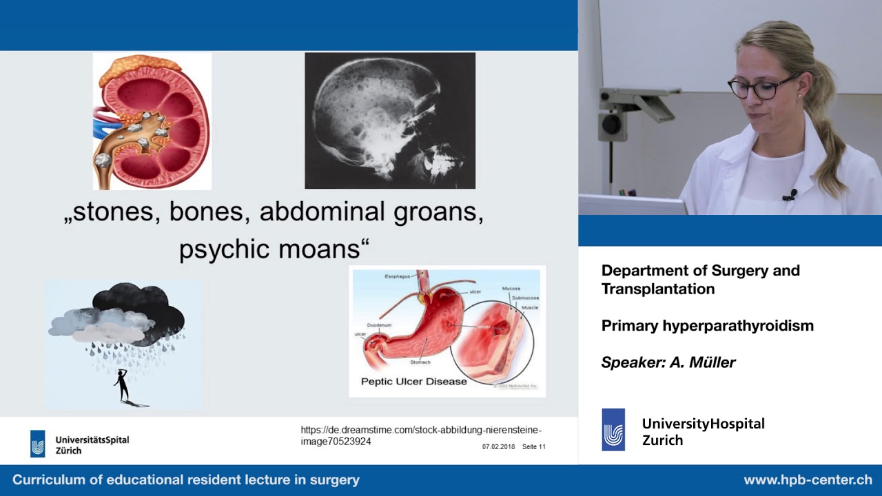 Primary hyperparathyroidism