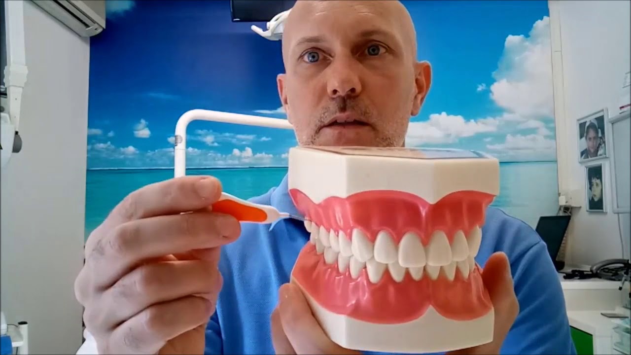 VUOI ANDARE MENO DAL DENTISTA? USA LO SCOVOLINO INTERDENTALE!