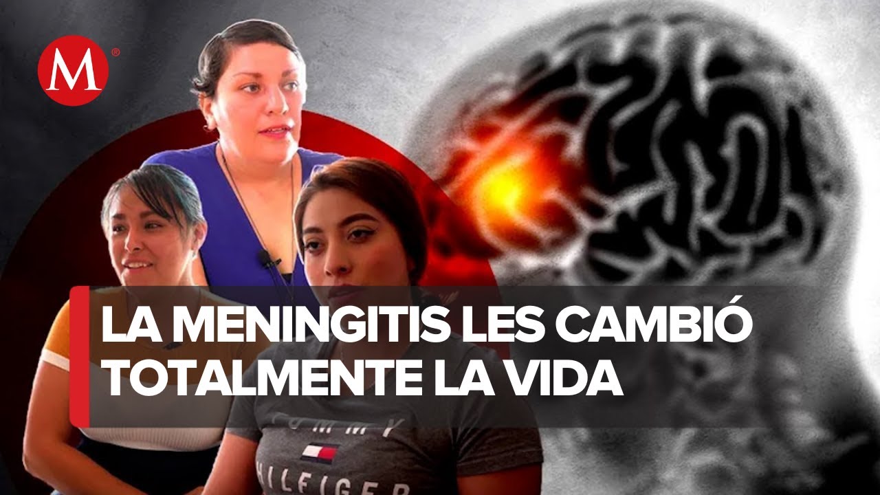 Secuelas por brote de Meningitis en Durango, desde alergias hasta parálisis