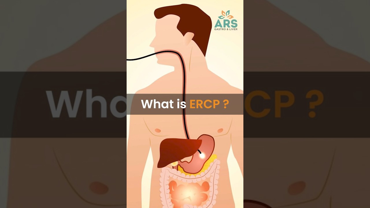 What is ERCP? | Understanding ERCP (Endoscopic Retrograde Cholangiopancreatography)