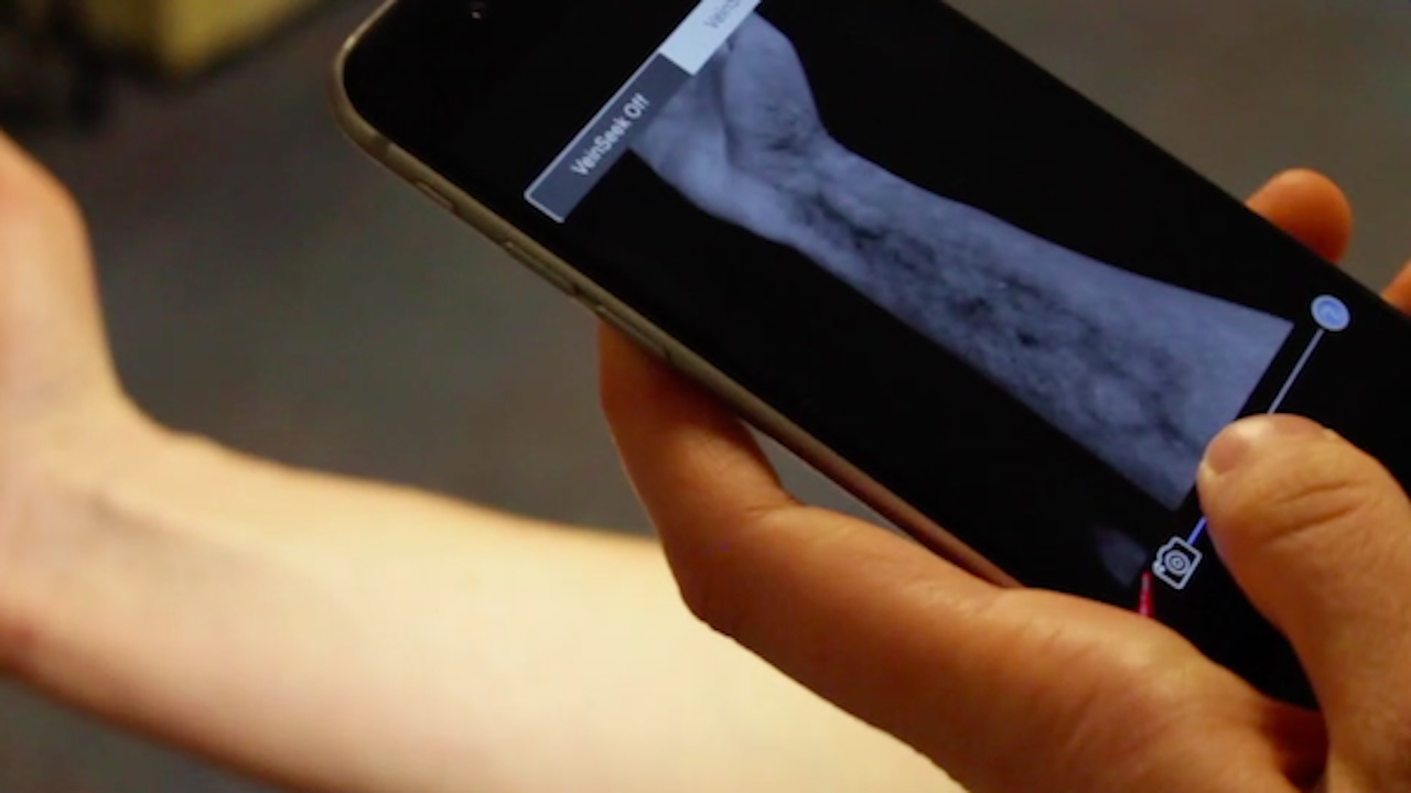 VeinSeek Pro: Vein Finder App for iPhone