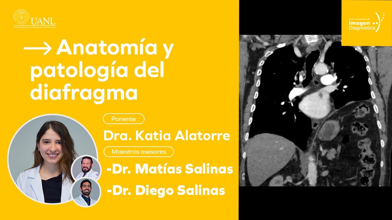 Anatomía y patología del diafragma por la Dra. Katia Sofía Alatorre Plascencia.