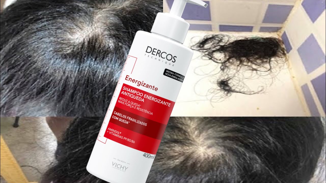 O MELHOR SHAMPOO ANTI-QUEDA | Minha Solução