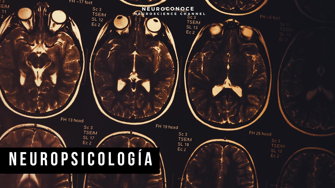 El poder de la neuropsicolog&iacute;a: C&oacute;mo la ciencia del cerebro puede transformar tu vida.