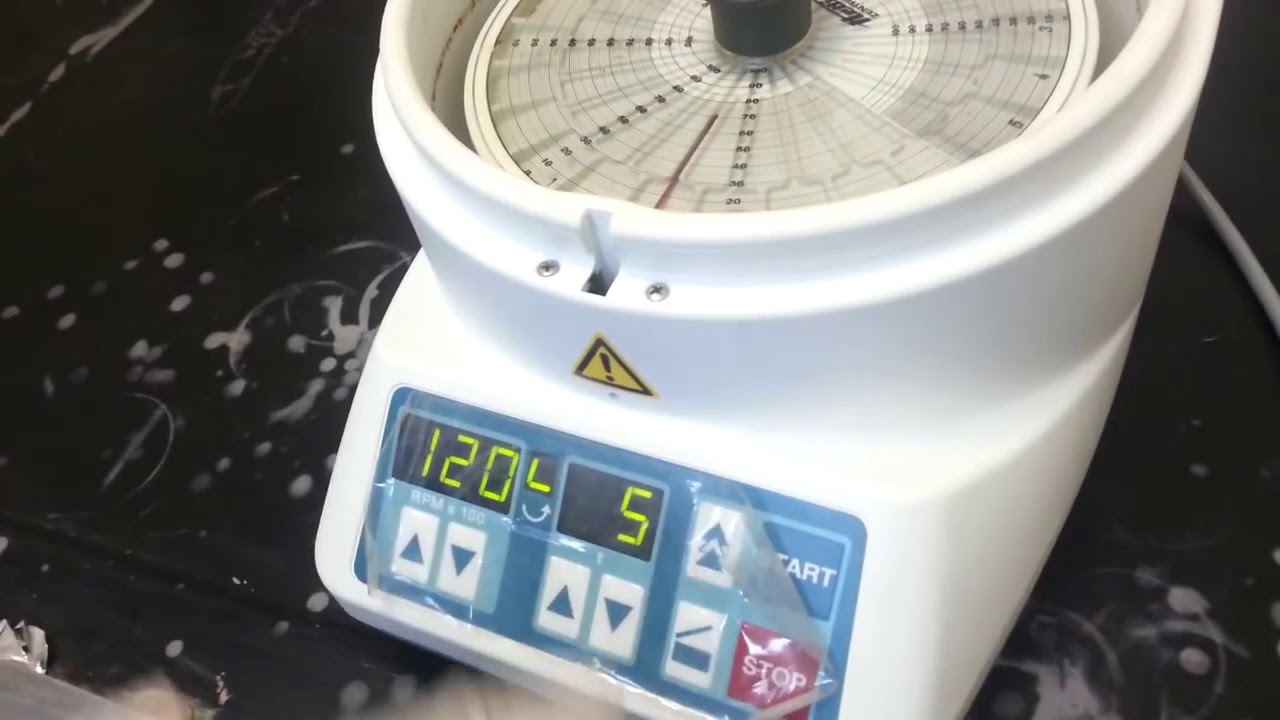 How to Use of Hematocrit Centrifuge experience  Clinical Hospital.