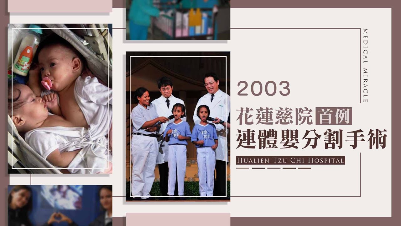 慈濟精選│2003年 花慈院首例連體嬰分割｜大愛新聞 @DaaiWorldNews