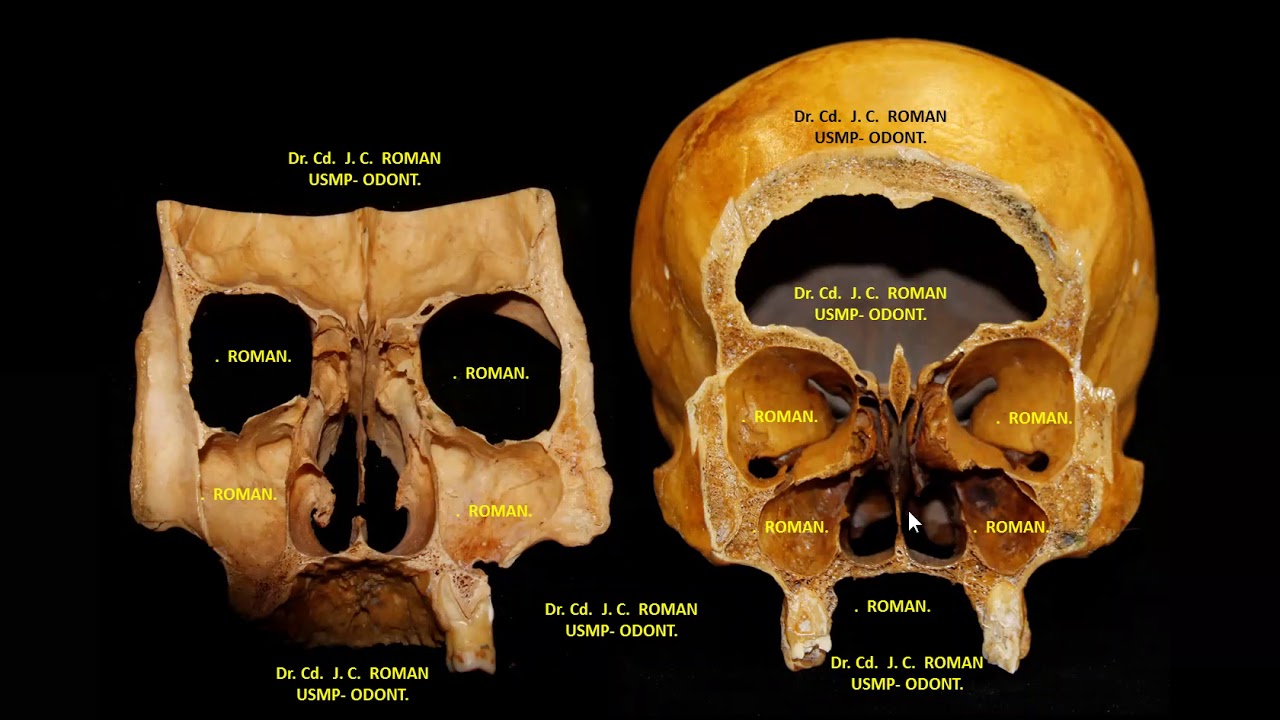 SENO MAXILAR Y ANATOMIA DENTO ALVEOLAR 2   J.C.R.E  USMP - ODONT.