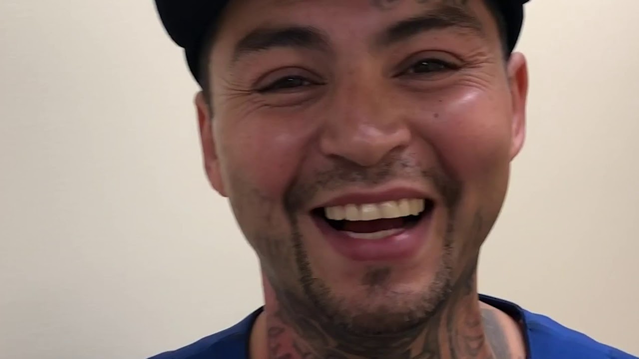Disappearing Ink - Gang Tattoo Removal