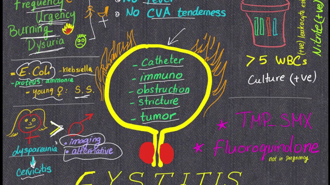 Cystitis Review in 4 minutes, All you need to know